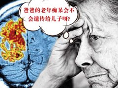 老年癡呆癥會(huì )不會(huì )遺傳