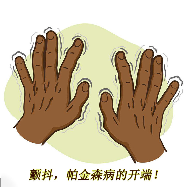顫抖，帕金森病的開(kāi)端 帕金森的早期癥狀